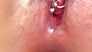 Simultaneous insertion of urethral mancoanal