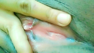 White pussy discharge