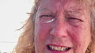 Putting Sunscreen on Every Last Freckle