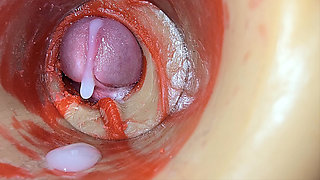 Female Insemination - Internal Camera Captures Deep Male Huge Ejaculation