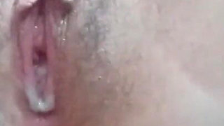 Anal Rupture