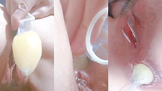 Assholegap Gaping Analstretch Analplay