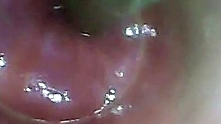 Endoscope POV: Test Tube Cock Urethral Insertion