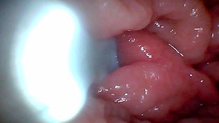 First Time: an Endoscope Reveals the G-spot up Close - Without Mounting!