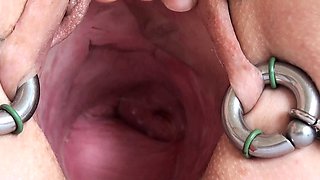 Real Cervix Fucking Insertion Objects in Uterus
