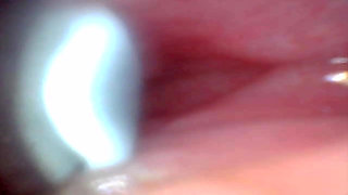 Endoscope Camera Captures Moment of Male Ejaculation 4K