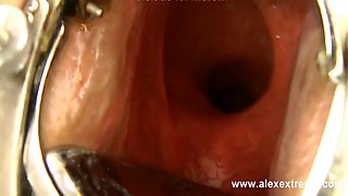 Extreme Anal Fisting, Giant Dildos And Prolapse Compilation From Alexextreme 30-46