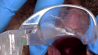 Hairy Mature Pussy Examined by Two Doctors