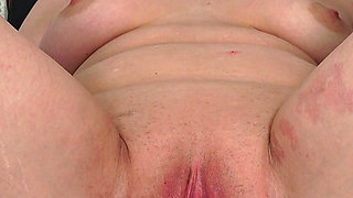 Mature Gyno Exam-Cervix examination with speculum + vaginal irrigation